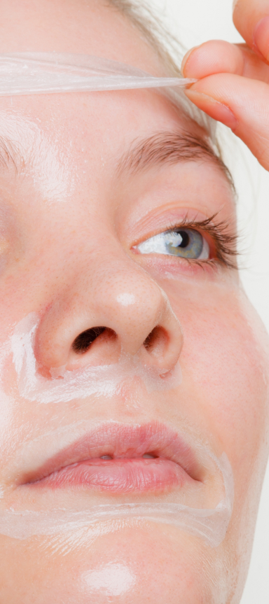 Peeling Issy-les-Moulineaux