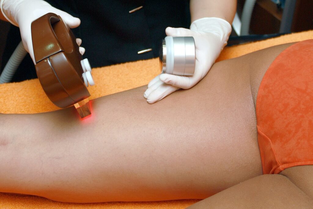 Épilation laser maillot